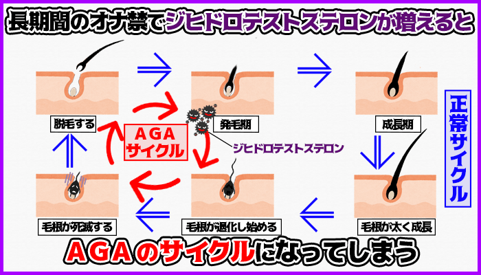 ジヒドロテストステロンが増えるとはげやすくなるの図