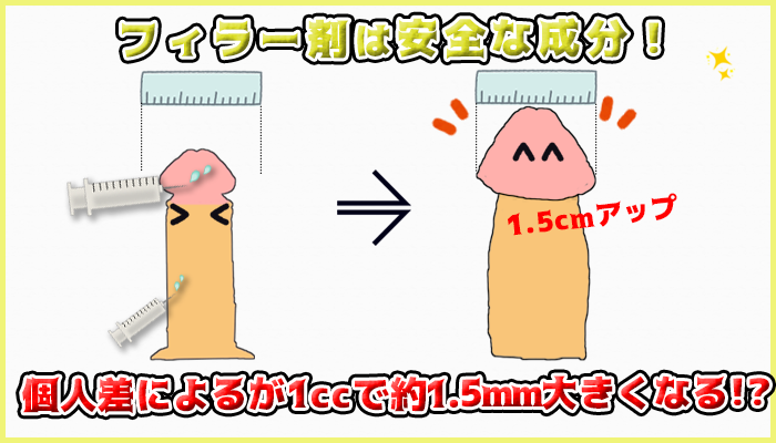 増大手術に使われるフィラー剤の説明の図